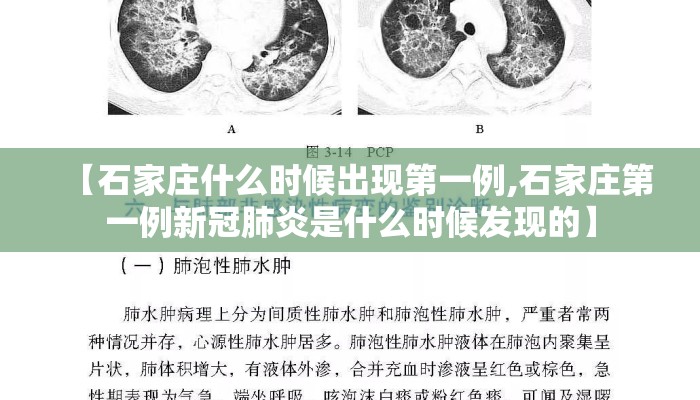【石家庄什么时候出现第一例,石家庄第一例新冠肺炎是什么时候发现的】