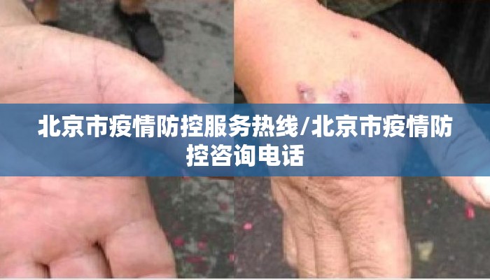北京市疫情防控服务热线/北京市疫情防控咨询电话