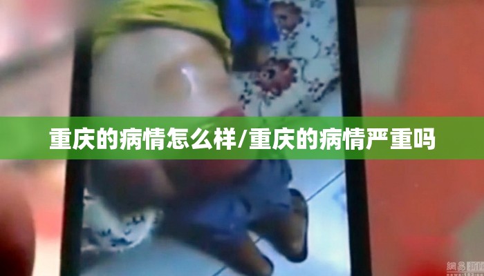 重庆的病情怎么样/重庆的病情严重吗