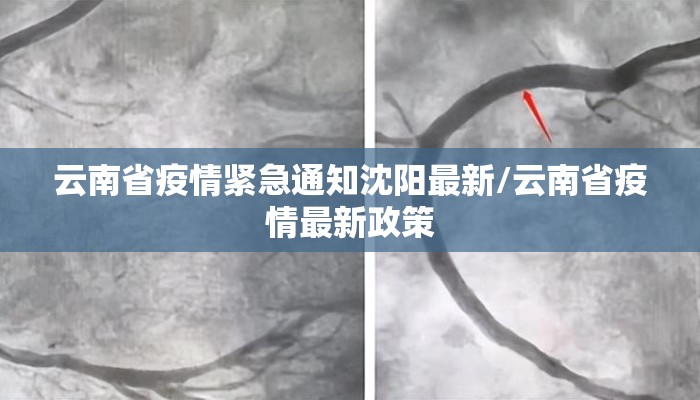 云南省疫情紧急通知沈阳最新/云南省疫情最新政策 云南省疫情紧急通知沈阳最新/云南省疫情最新政策
