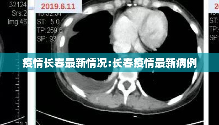 疫情长春最新情况:长春疫情最新病例