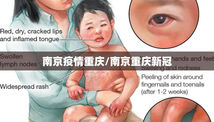 南京疫情重庆/南京重庆新冠