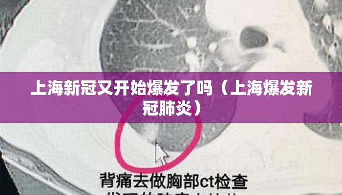 上海新冠又开始爆发了吗（上海爆发新冠肺炎）