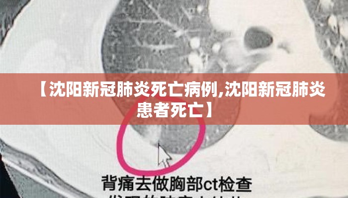 【沈阳新冠肺炎死亡病例,沈阳新冠肺炎患者死亡】