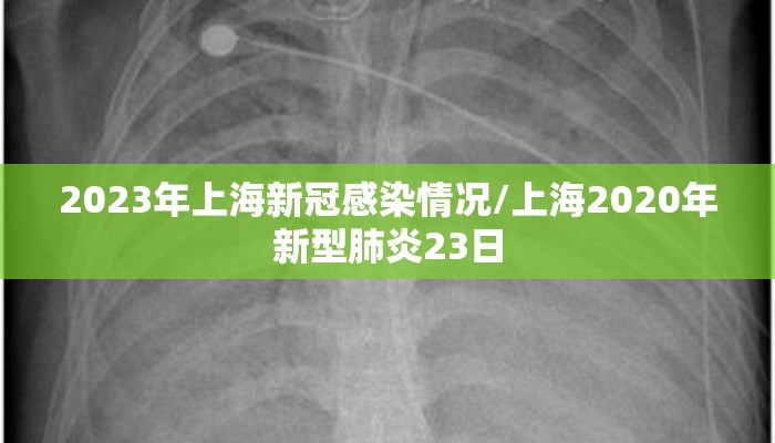2023年上海新冠感染情况/上海2020年新型肺炎23日