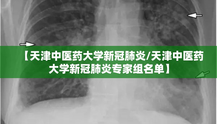 【天津中医药大学新冠肺炎/天津中医药大学新冠肺炎专家组名单】
