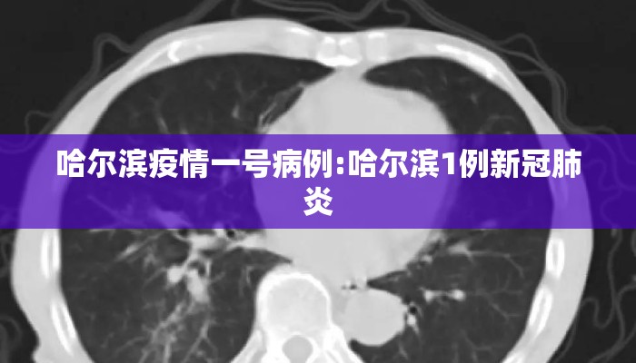 哈尔滨疫情一号病例:哈尔滨1例新冠肺炎 哈尔滨疫情一号病例:哈尔滨1例新冠肺炎