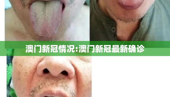 澳门新冠情况:澳门新冠最新确诊