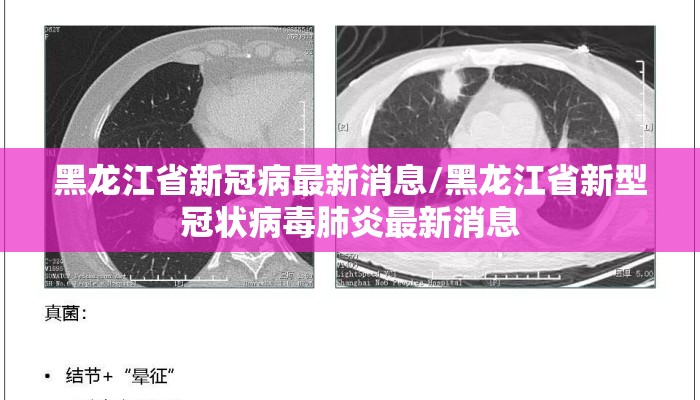黑龙江省新冠病最新消息/黑龙江省新型冠状病毒肺炎最新消息
