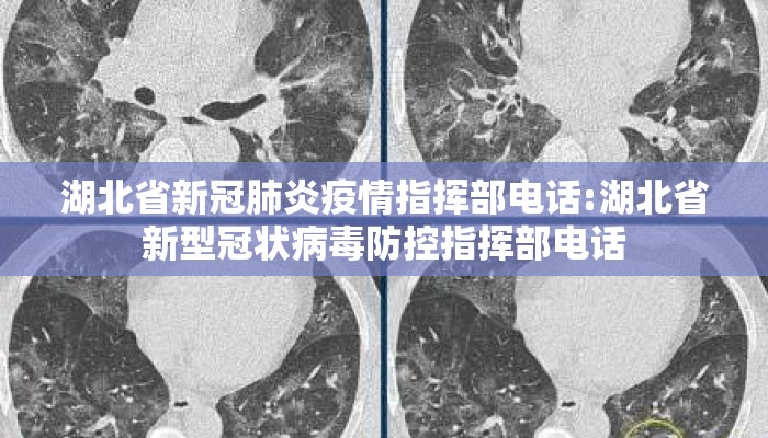湖北省新冠肺炎疫情指挥部电话:湖北省新型冠状病毒防控指挥部电话
