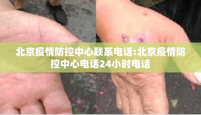 北京疫情防控中心联系电话:北京疫情防控中心电话24小时电话 北京疫情防控中心联系电话:北京疫情防控中心电话24小时电话
