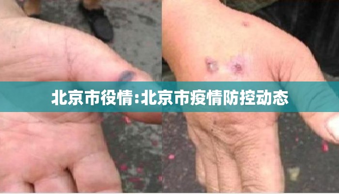 北京市役情:北京市疫情防控动态