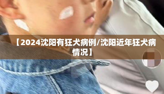 【2024沈阳有狂犬病例/沈阳近年狂犬病情况】